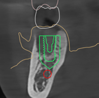 관상면 (Cross-sectional View)