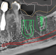 시상면 (Sagittal View)